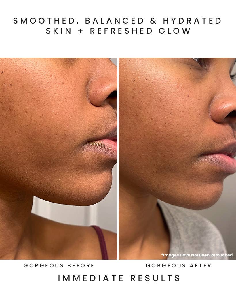 Earth Harbor Naturals - CLOUDBURST Plumping Balance Essence: Hyaluronic Superherbs