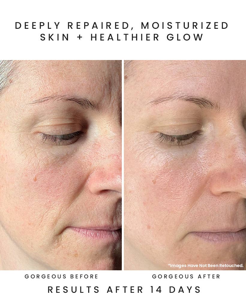 Earth Harbor Naturals - NYMPH NECTAR Superfruit Repair Balm: Sea Vitamin C