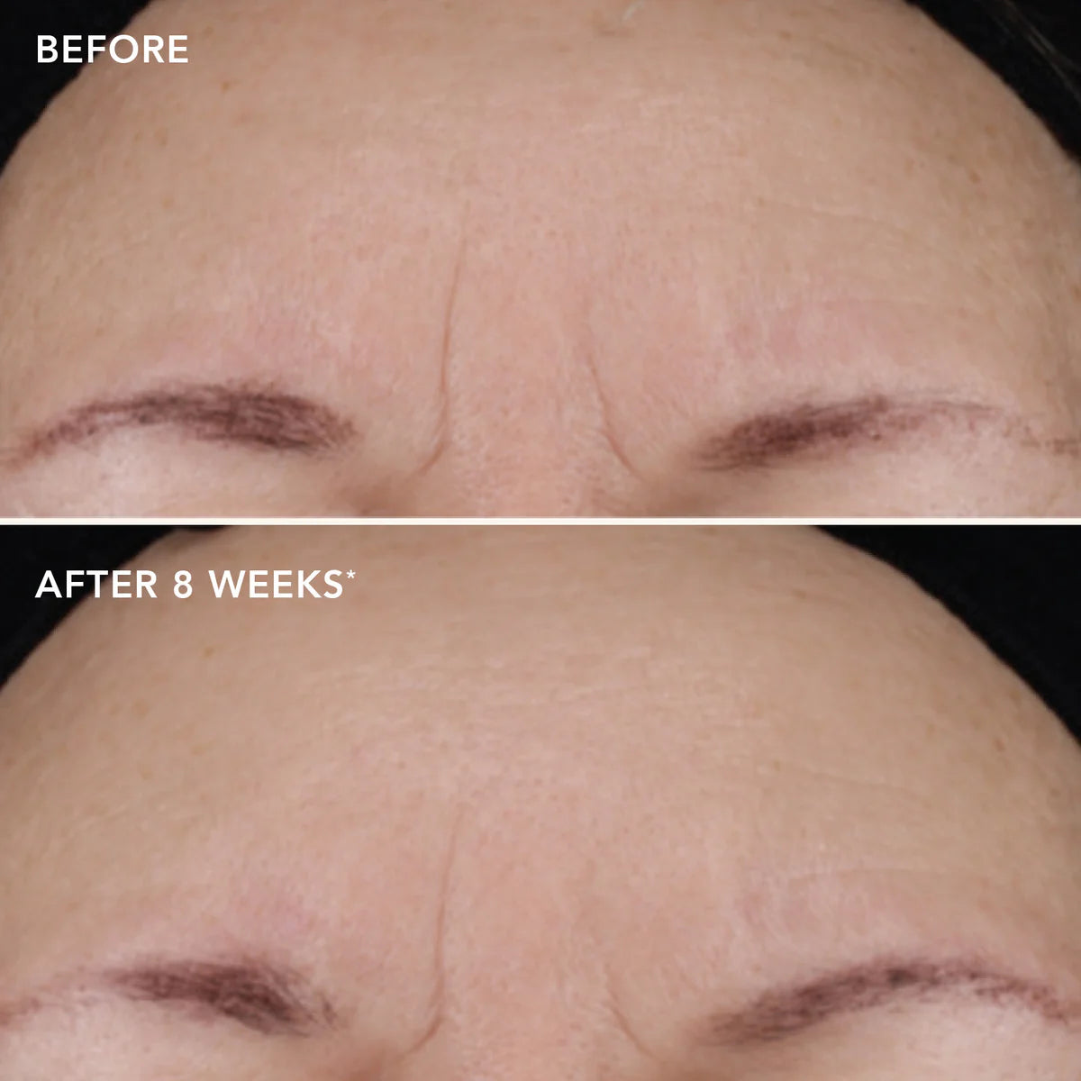 Image skincare AGELESS+ retinol treatment crème 1.2% retinol complex